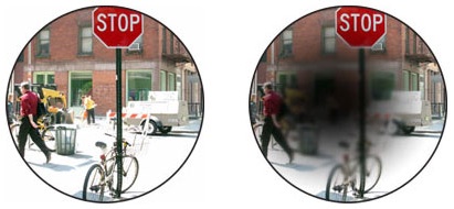 A comparison of normal vision of a street scene with macular degeneration showing a scotoma (blind spot) in the middle